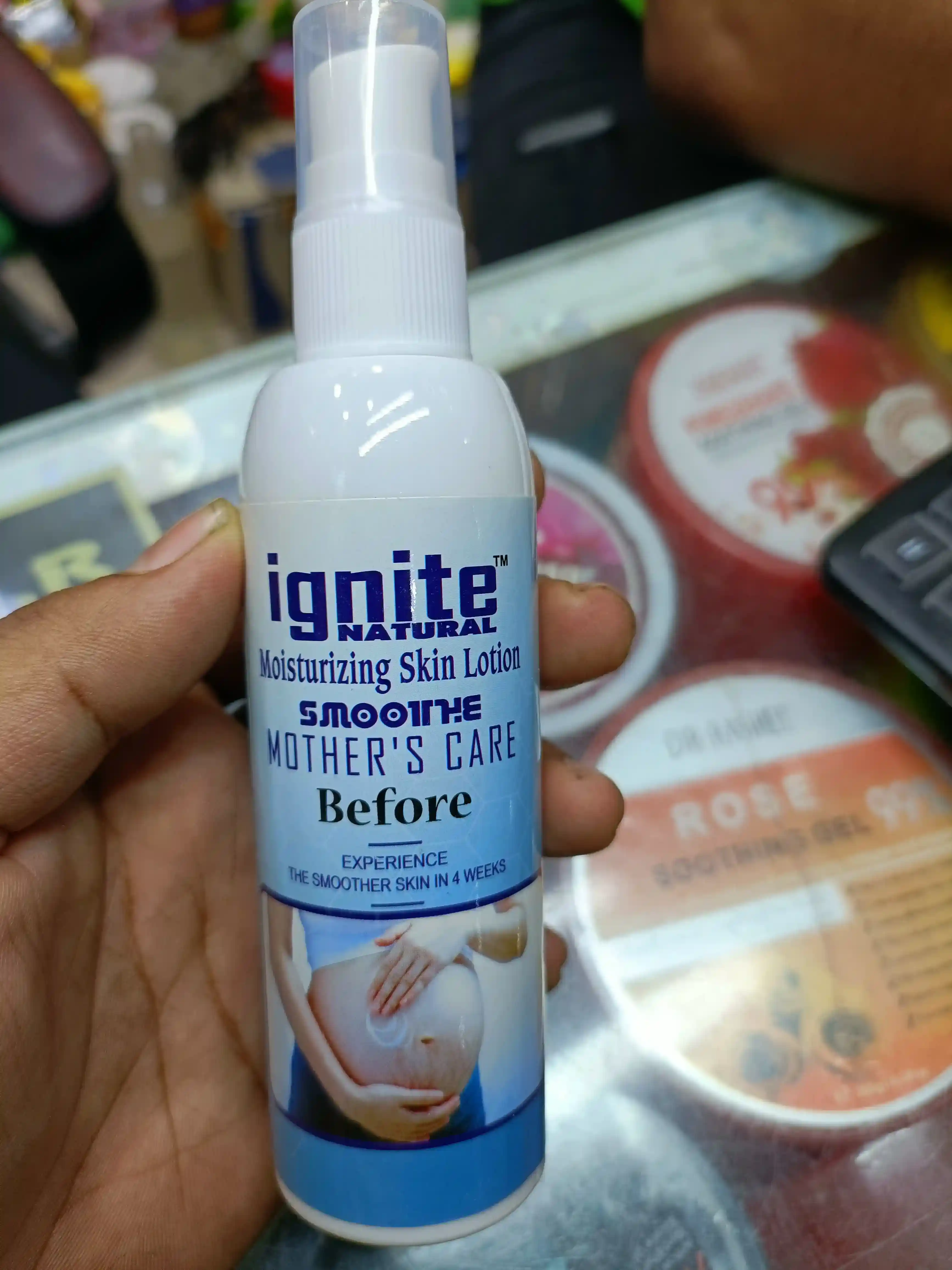 ignite mother care lotion